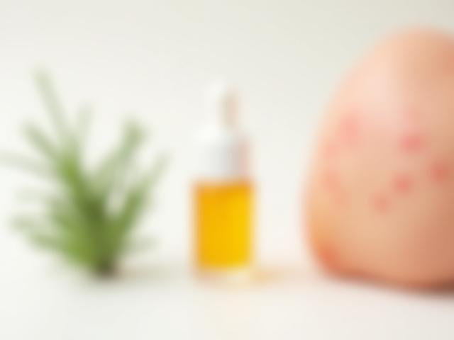 Diagram illustrating plant extraction, concentrated essential oil, and resulting skin irritation.